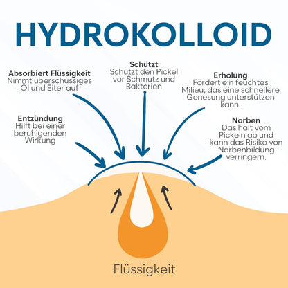 Unsichtbare Pickel Patches (180 Stück) – Hydrocolloid Pflaster für schnelle Akne-Linderung, ideal für Gesichtspflege, in praktischen Größen S/L